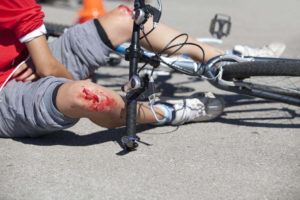 injured cyclist laying on the floor after motor vehicle accident