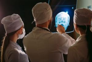 doctors review a patient’s brain scan